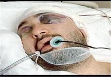 اعضای بدن شاهسوندی، اسکیباز به کما رفته کشورمان اهدا شد اعضای بدن شاهسوندی، اسکیباز به کما رفته کشورمان اهدا شد